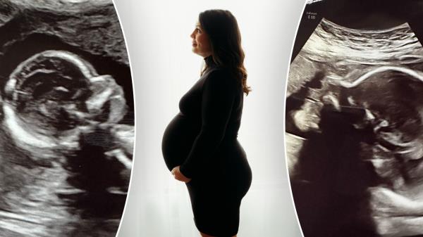 阿拉巴马州妇女的奇迹怀孕，腹部脂肪与痴呆症的联系，以及最新的睡眠趋势